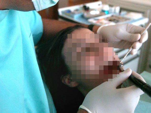 Dentista falso operava davvero