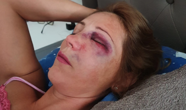 Aggredita a Gallarate: c’è un sospettato