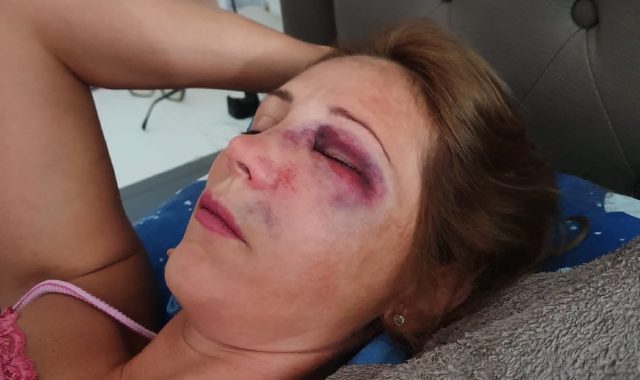 La vittima dell’aggressione avvenuta al Carrefour di Gallarate (foto Redazione)