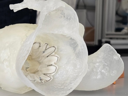 Doppio impianto di protesi a cuore battente, dopo prova in 3D