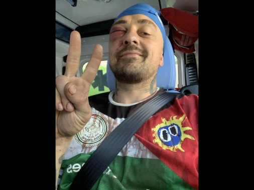 Chef Rubio, '60 pugni mirati e preso a mattonate'