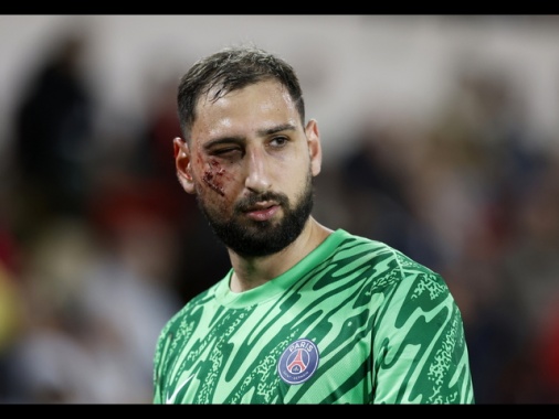 Tremendo scontro con Singo, infortunio Donnarumma in Monaco-Psg