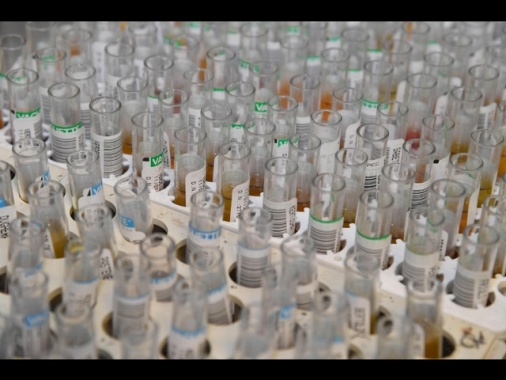 Mangia insaccato con batterio e muore, accusato produttore