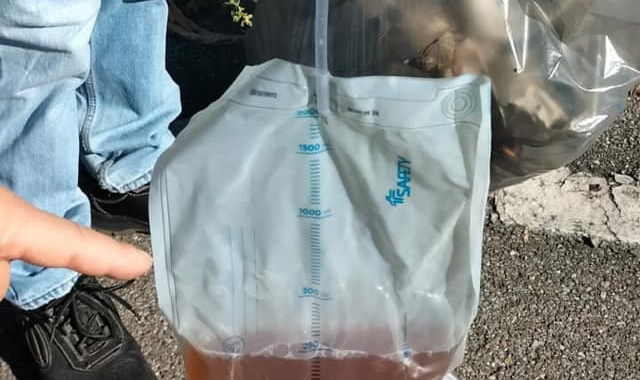 Il catetere ritrovato per strada a Caronno Pertusella