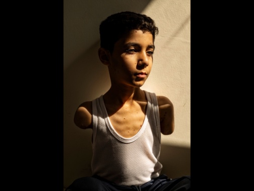 World Press Photo, il bambino amputato a Gaza è foto dell'anno