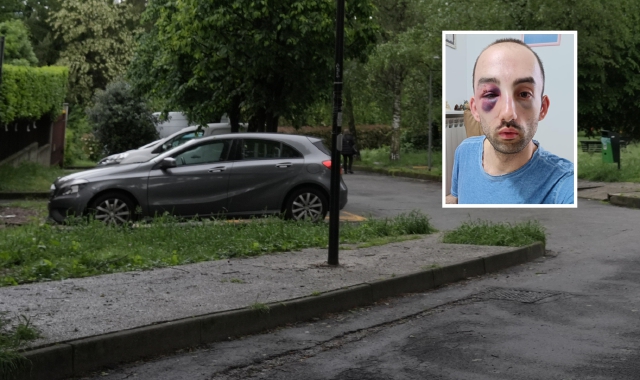 Il luogo dove è avvenuta l’aggressione (foto Andrea Cogotti/BLITZ). Nel riquadro, Tomas Levati, vittima del pestaggio