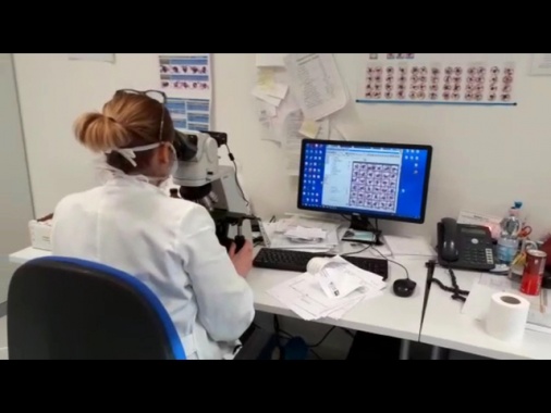 Primo paziente al mondo trattato con editing genetico su misura