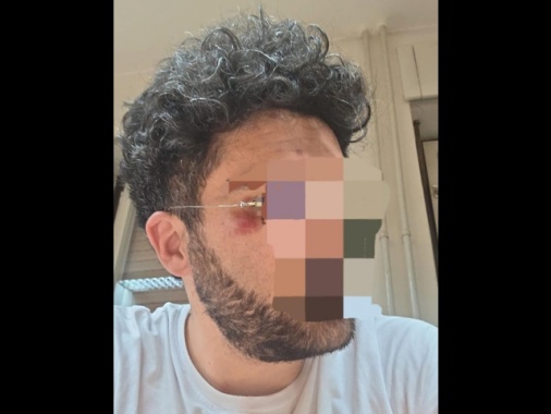 Pestati allo stadio di Zagabria, 'botte perché italiani'