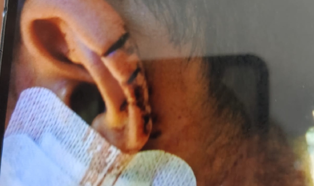 Altra rissa in stazione a Gallarate: soccorsi tre giovani