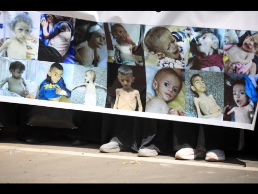 Msf, a Gaza un quarto dei bimbi e delle mamme è malnutrito