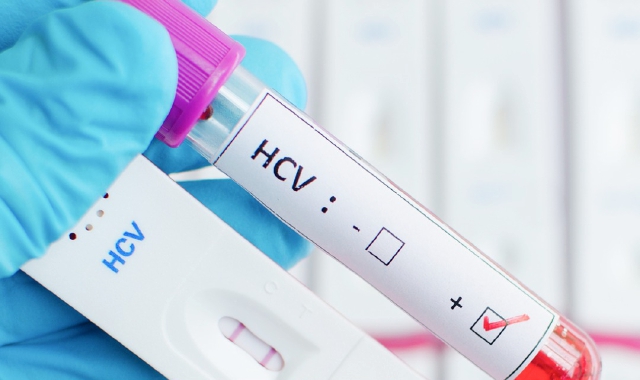 La prevenzione per l’epatite C passa da Varese e Legnano