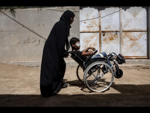 Onu, almeno 21.000 bimbi a Gaza disabili a causa guerra