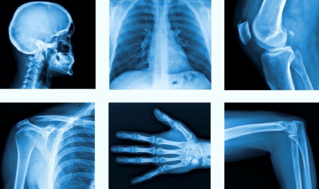 Nessuna violenza sessuale: tecnico radiologo assolto