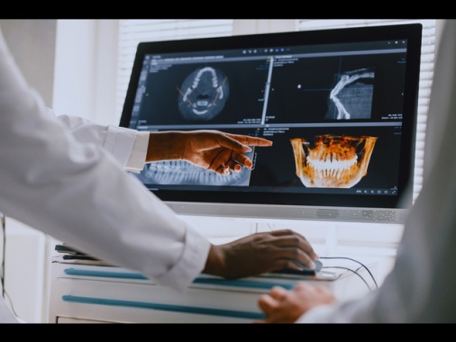 Staminali a gel rigenerano ossa e gengive, impianti più rapidi