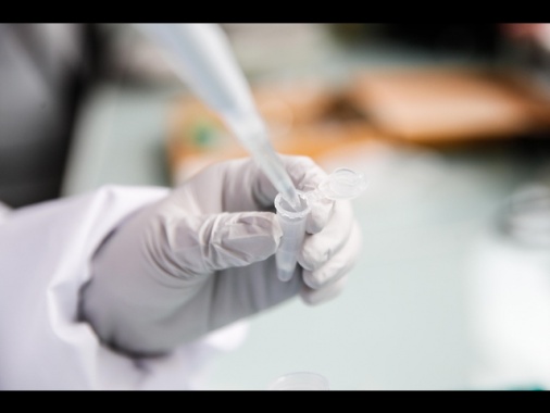 Emofilia B, primo paziente italiano curato con terapia genica